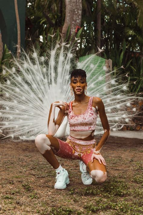 Winnie Harlow in Bikini - V Magazine Photos • CelebMafia