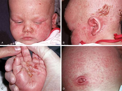 Dermatology - Clinical Tree
