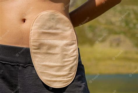 Premium Photo | Woman with colostomy bag in the mountains Close up