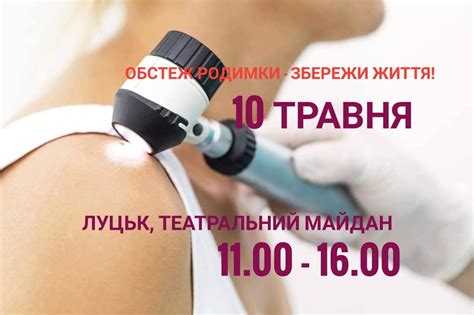 Лучани зможуть безкоштовно перевірити родимки - Волинь Online