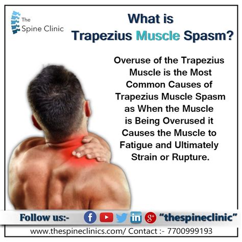 WHAT IS TRAPEZIUS MUSCLE SPASM. WHAT IS TRAPEZIUS MUSCLE SPASM | by The ...