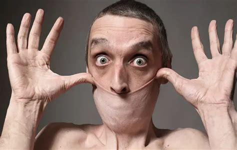 20 People Who Hold the Record for Largest Human Body Parts