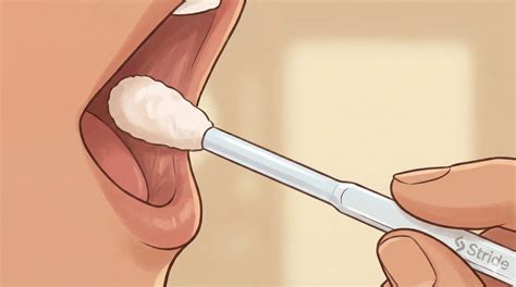 Stride | MTHFR Gene Test (Methylenetetrahydrofolate Reductase): What It