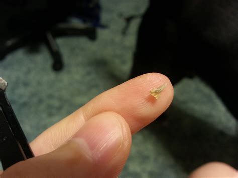 So I just pulled this out of my belly button. : popping