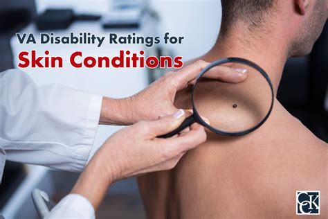 Va Cp Exam For Skin Condition