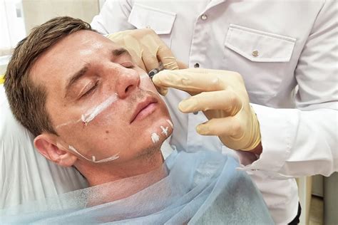 Лучшие процедуры для мужчин в косметологии - Estelaser