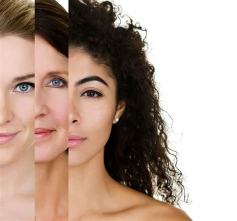skin types  conditions