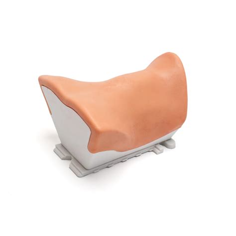 Anterior Approach – Realists