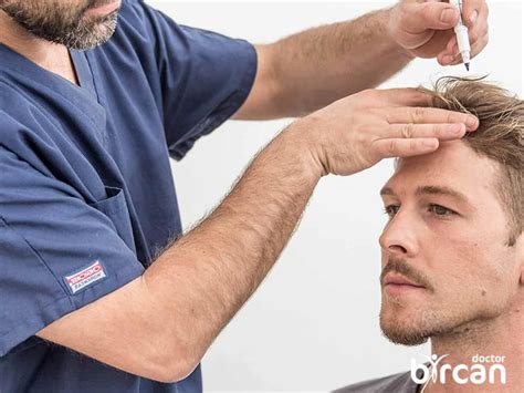 fue technique fue hair transplant method