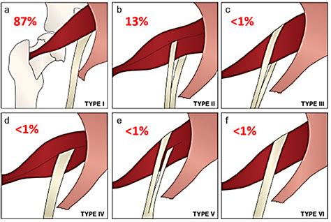 Greater Sciatic Foramen Piriformis