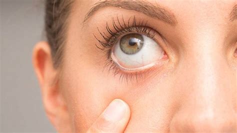 8 Home Remedies for Dry Eyes That Work – Entirely Health