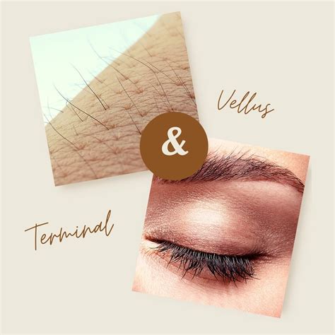 how long for vellus hair to become terminal