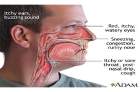 Sinus Drainage Bad Breath at Margaret May blog