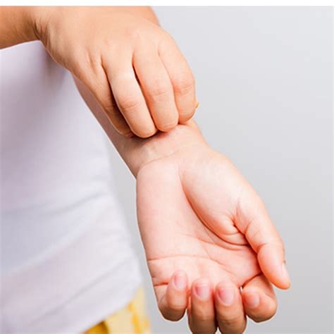 infections infestations  bites