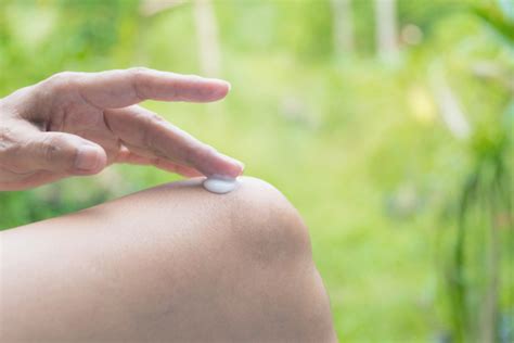 乾癬｜体の皮膚がポロポロ剥がれる病気。かゆみ・痛みも。治すにはどうする？ | Medicalook(メディカルック)