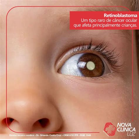 O'que É Retinoblastoma - Nova Clinica Luz - O que é o Retinoblastoma?