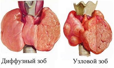 ТТГ понижен: что это значит, чем опасен для женщин, мужчин, при ...