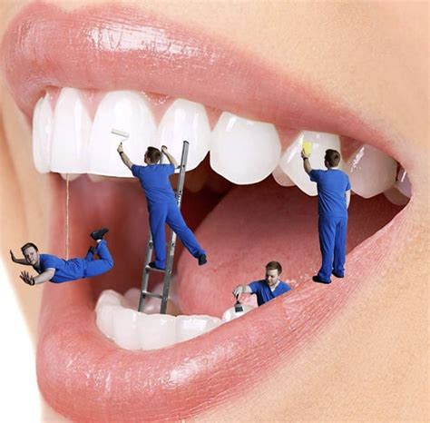 Épinglé par Shaker Hussein sur Dental art | Dentiste, Dentaire, Art ...