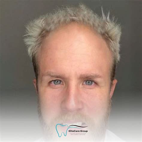InfluencerGoneWild's Before & After: Is It All Natural? Image 2