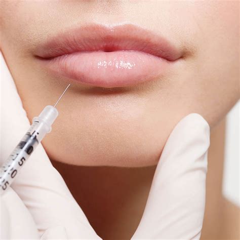 Lip Filler - MORDI Beauty Clinic