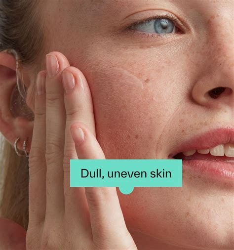 glowing skin treatments   treat glowing skin dermatica