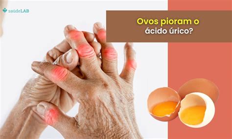 Ovo E Banana Faz Mal - Comer banana verde faz mal? Entenda quais os riscos envolvidos