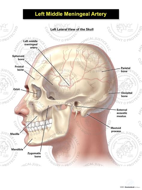 Left Middle Meningeal Artery