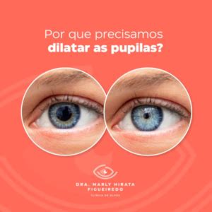 Pupilas Dilatadas O Que Pode Ser - Por que precisamos dilatar as pupilas? - Dra Marly Hirata Figueiredo ...