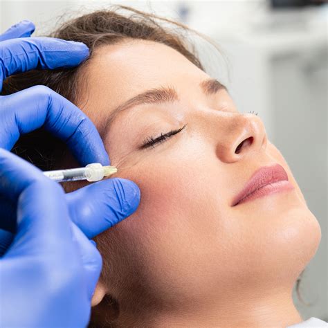 Botox | VITALIE