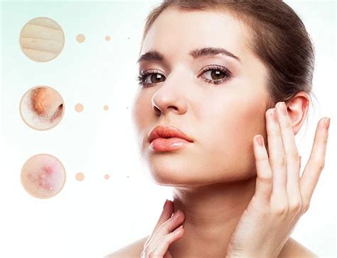 dermatology top dermatologists  ghaziabad