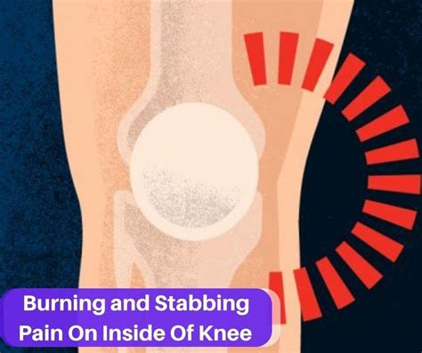 burning  stabbing pain    knee