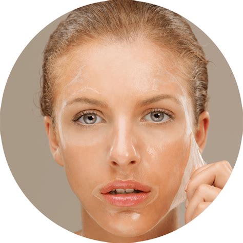 chemical peels  acne scars  la myimage skin body