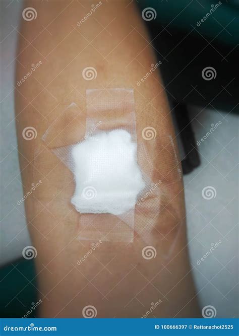 Gauze dressing. stock image. Image of dressing, gauze - 100666397