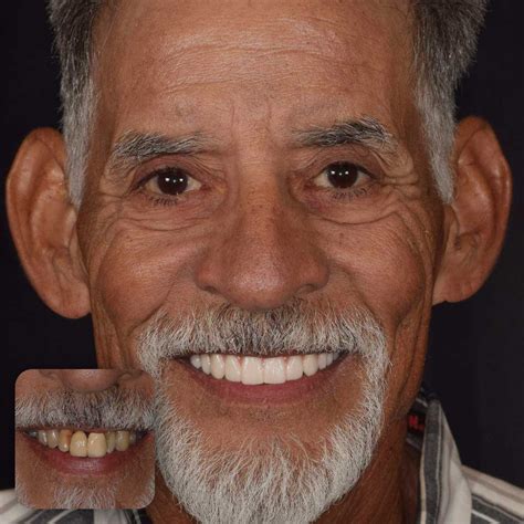 Travel for Treatment - Doctors Implants