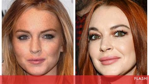 Lindsay Lohan Drogas E Alcool - Depois do álcool e das drogas! Lindsay Lohan tem o vício do botox e das ...