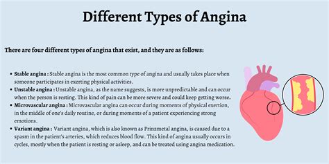 First Aid For An Angina Attack - First Aid for Free
