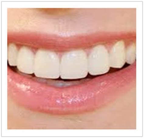 cosmetic dentistry singapore