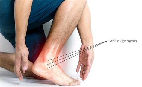 Ankle Sprain Injury Treatment » Curezone Physiotherapy