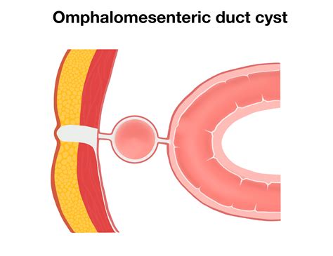 Duct Vitellointestinal Definition at Darren Pennington blog