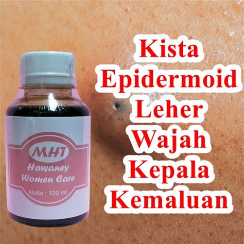 jual obat kista epidermoid  wanita hawaney women care mht