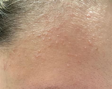 Hi! Can someone help me, please? Does anyone know what could cause this ...