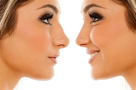 rid  fat   nose eshealthtips
