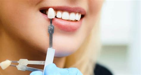 finance dental implants  ways