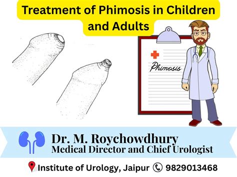 Urethroplasty for Male Urethral Strictures