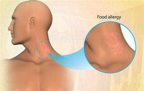 Health Condition : Symptoms, Causes, Treatment and More