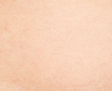 tekstur kulit foto stok  gambar  close  dermatologi