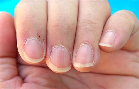 DIY Cuticle Oil Recipe for Dry, Cracked Cuticles
