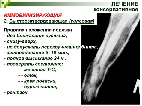 Болезни костей - online presentation
