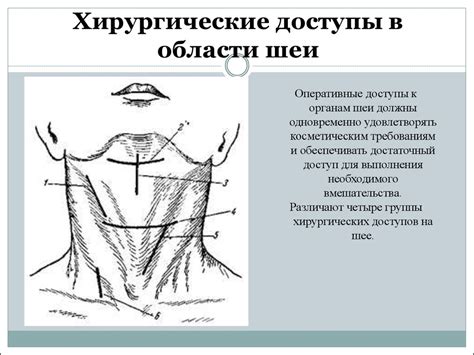 Операции в области шеи - online presentation