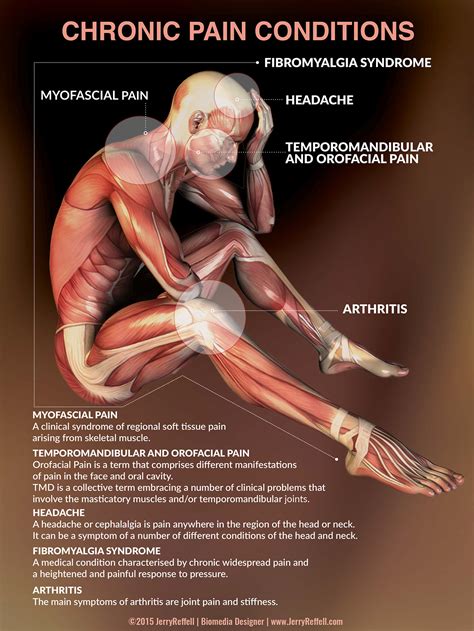 chronic pain conditions behance